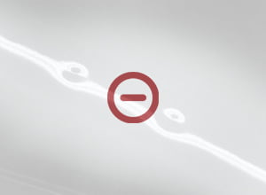 G_overview_pdr-glue_001-small-NA Dent Pulling products are not included